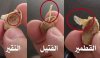 القمطيروالفتي .jpg