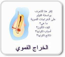 83_asnan.jpg