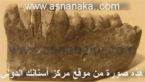asnanaka_branemark1.jpg