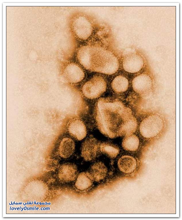 swine-flu-02.jpg