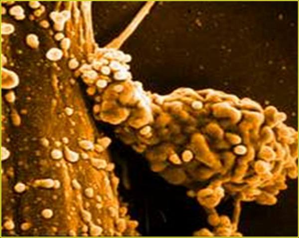 picture_embryo_4.JPG