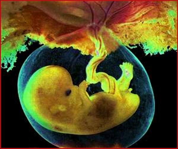 picture_embryo_8.JPG