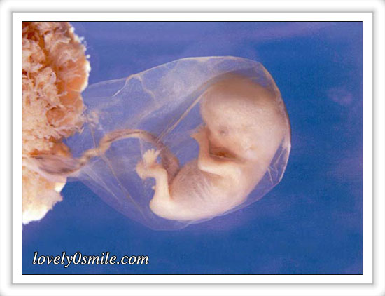 fetus-03.jpg